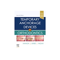 Elsevier - Health Sciences Division Temporary Anchorage Devices in Orthodontics (inbunden, eng)