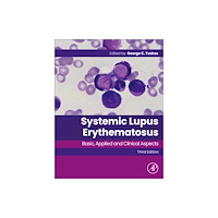 Elsevier Science Publishing Co Inc Systemic Lupus Erythematosus (häftad, eng)
