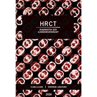 Carl Lamm HRCT : diagnostik och sjukdomsöversikt (bok, danskt band)