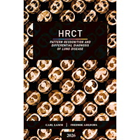 Carl Lamm HRCT : pattern recognition and differential diagnosis of lung disease (bok, danskt band, eng)