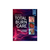 Elsevier - Health Sciences Division Total Burn Care (inbunden, eng)